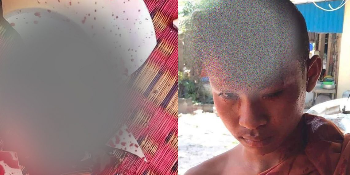 ពុទ្ធបរិស័ទភ្ញាក់ផ្អើលនៅពេលឃើញកូននេនមួយអង្គ ត្រូវគ្រូសូត្រឆ្វេងយកចានបោកព្រះកេសទាល់តែបែករបួសហូរឈាមគួរឱ្យសង្វេក (មានរូបភាពពិត)